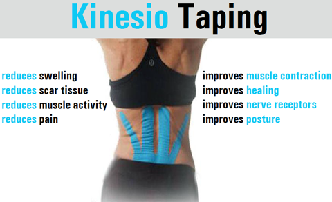 Kinesio Taping Spanish Fort, AL